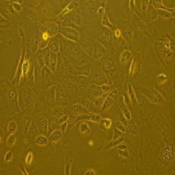 Human Diabetic Epithelial Cells-Type II (7)