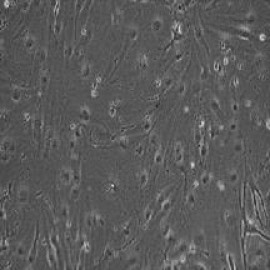 iPS-Derived Endothelial Cells