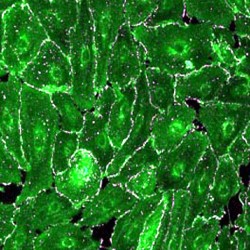 Human Hypertension Epithelial Cells (4)