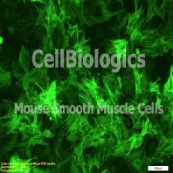 Diabetic Mouse Smooth Muscle Cells (12)