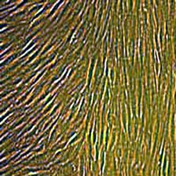 Human Smooth Muscle Cells (11)